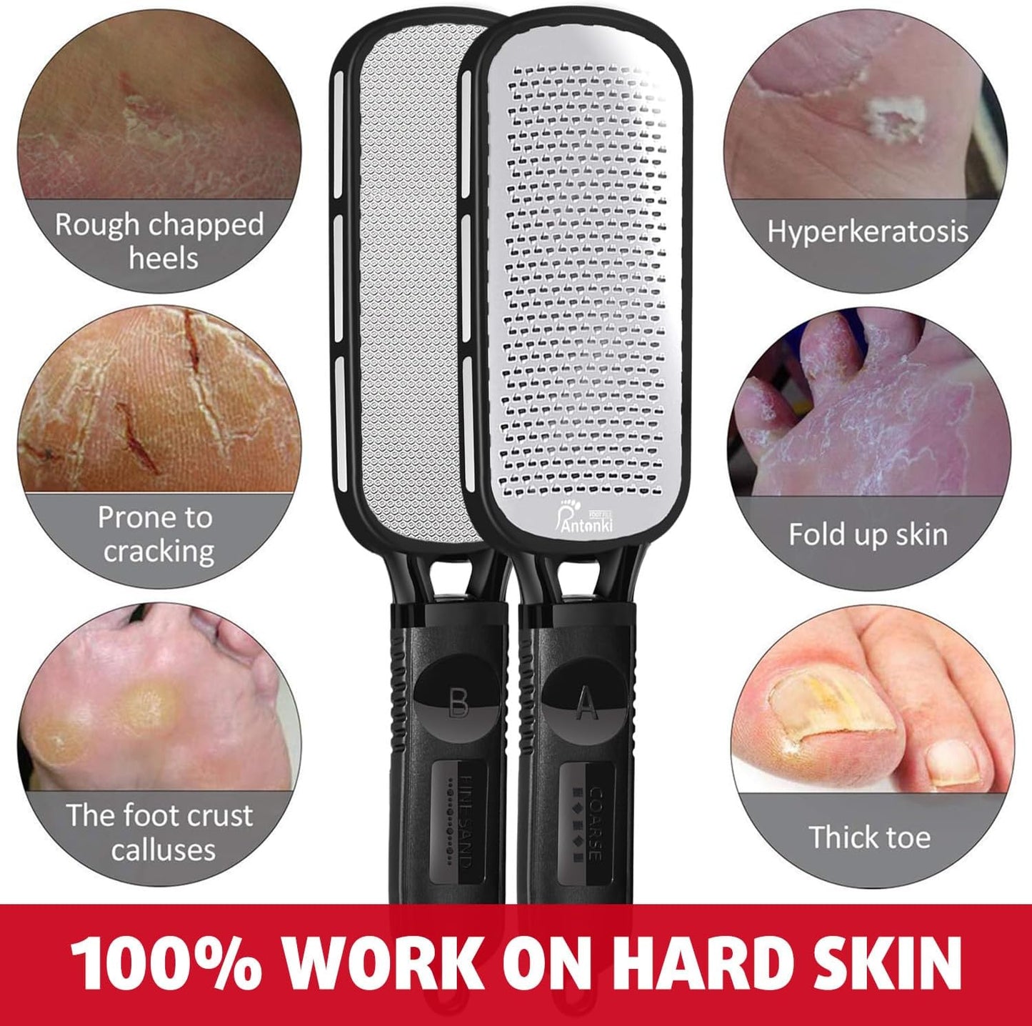Stainless Steel Professional Foot File and Callus Remover for Effective Dead Skin, Cracked Heel, and Corn Treatment