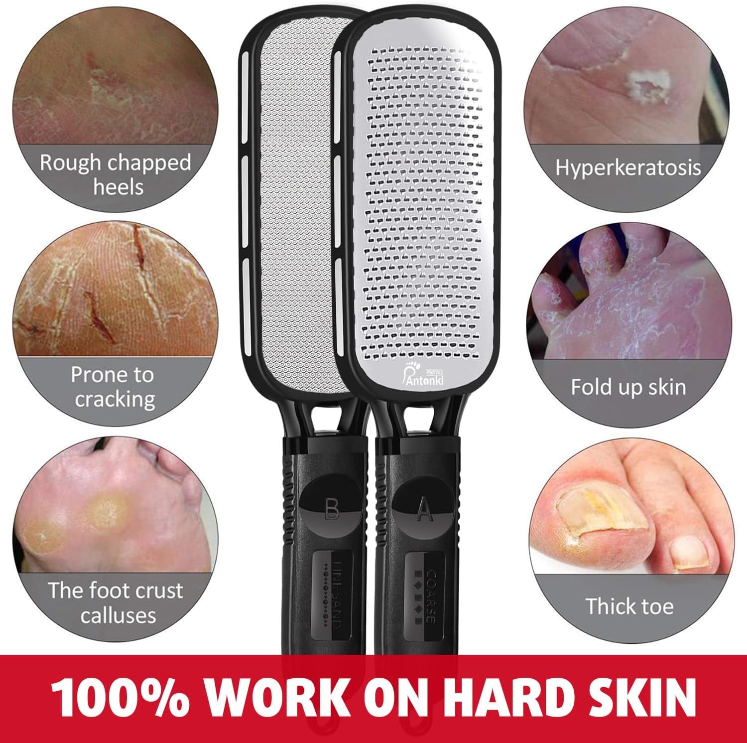 Stainless Steel Professional Foot File and Callus Remover for Effective Dead Skin, Cracked Heel, and Corn Treatment