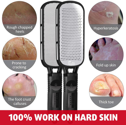 Stainless Steel Professional Foot File and Callus Remover for Effective Dead Skin, Cracked Heel, and Corn Treatment